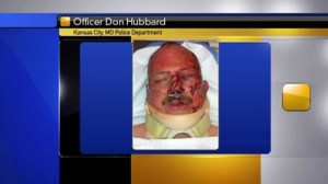FOX 4 obtained this photo with permission from the family of Master Patrol Officer Don Hubbard. It was taken after he was involved in a fight and shooting with assault suspect Anthony Bruno.