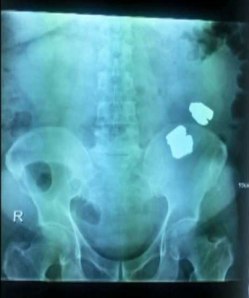 xray